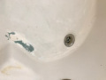 2_worn_enamel